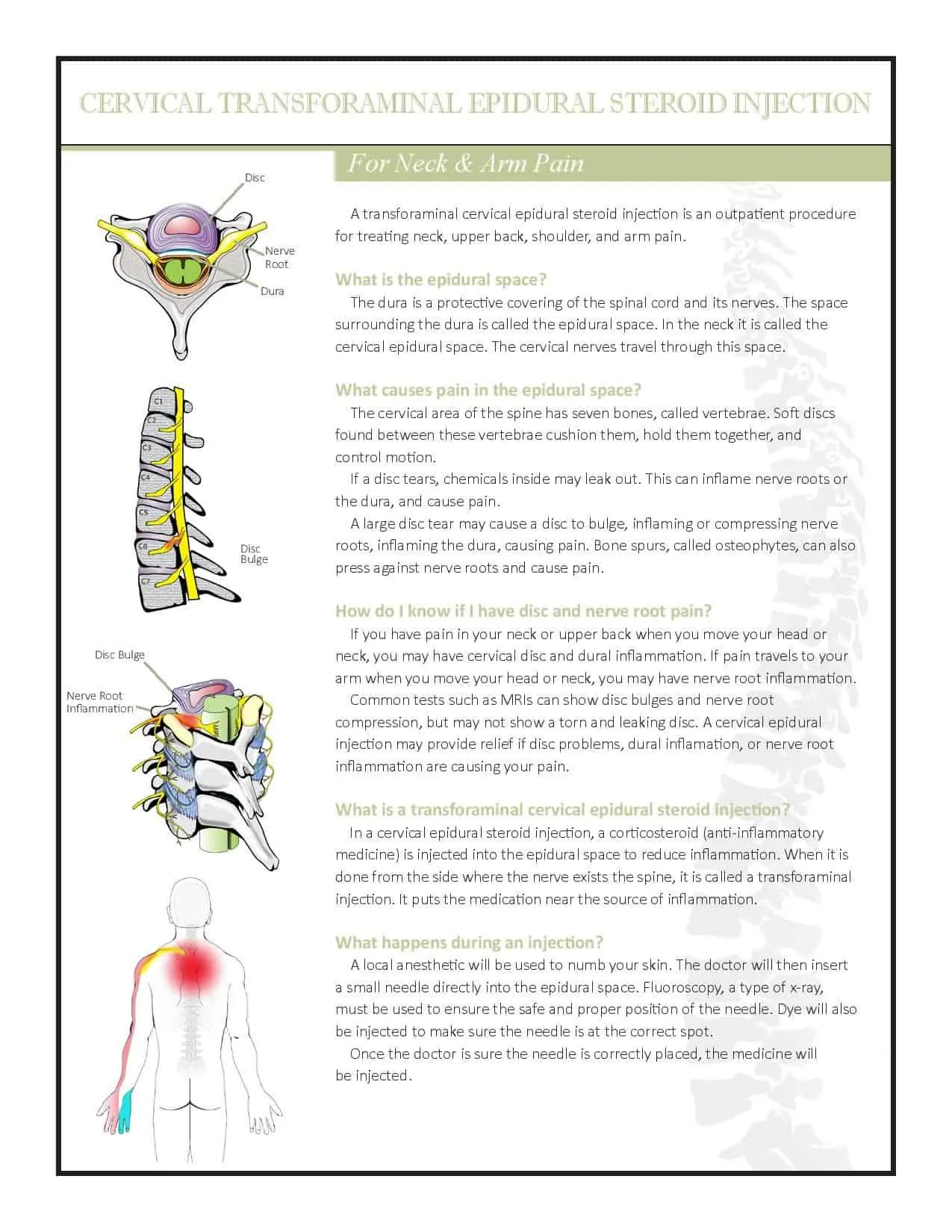 Cervical ESI TF Brochure PDF 2018-page-001