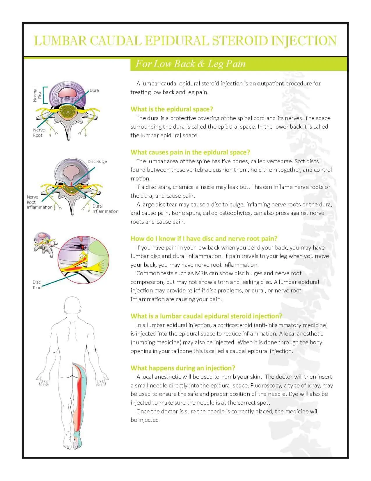 Lumbar ESI Caudal 2018-page-001