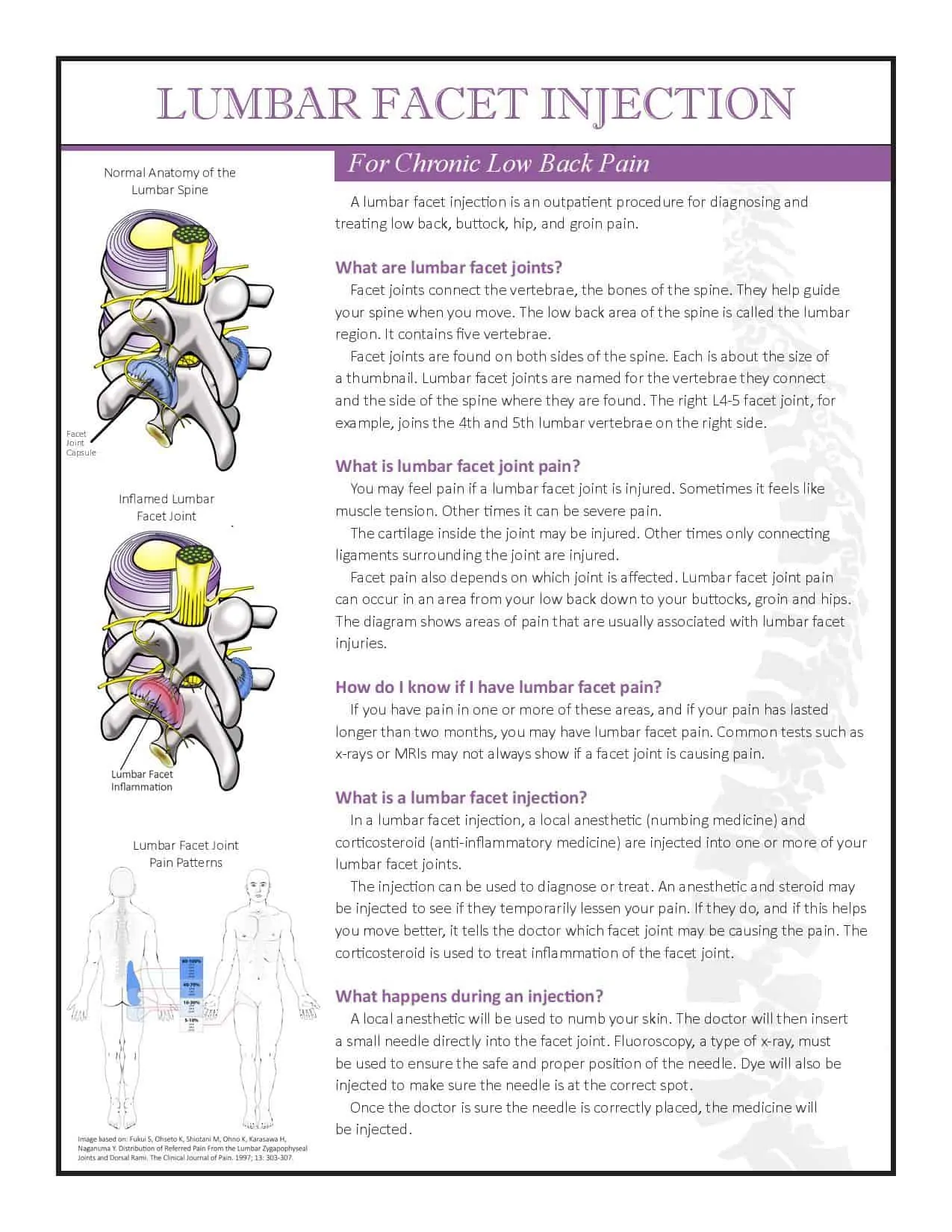 Lumbar Facet Injection Brochure PDF 2018-page-001