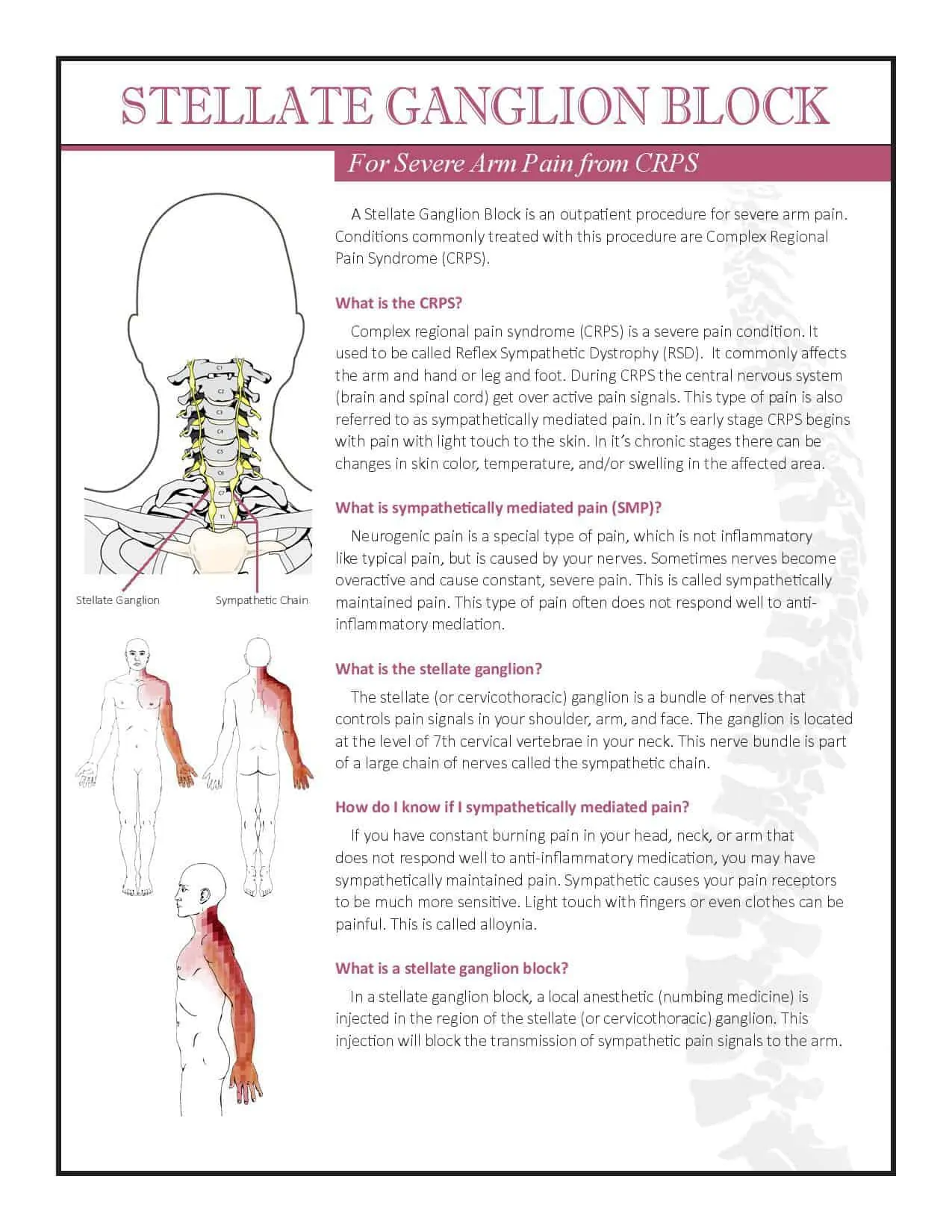 Stellate Ganglion Block 2016 for CRPS-page-001